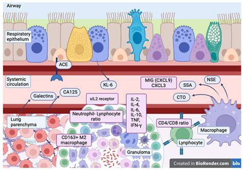 Phenotypes and Serum Biomarkers in Sarcoidosis