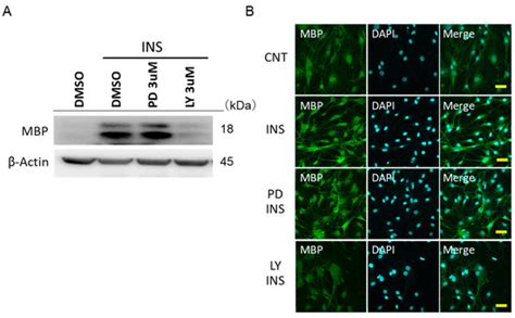 The Effects of Insulin on Immortalized Rat Schwann Cells, IFRS1