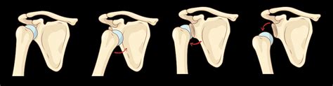 How Painful Is Dislocating a Shoulder? - Kyle McClintock, DO | Orthopedic Surgeon Roseville, CA