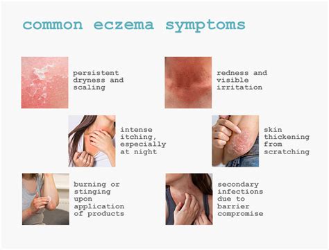 Eczema: A Clinical Look at Inflammation, Skin Barrier Damage, and Long