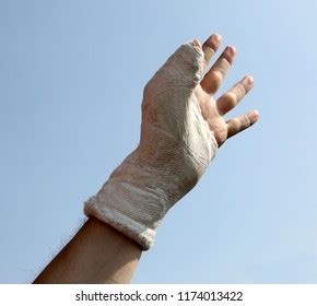 Hand Plaster 的图像结果