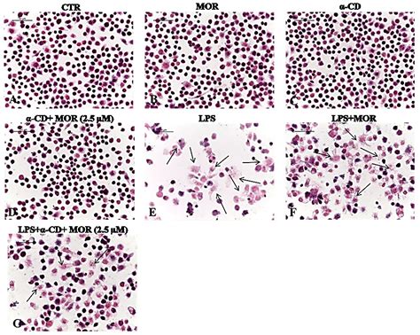 A Combined Approach of NMR and Mass Spectrometry Techniques Applied to ...