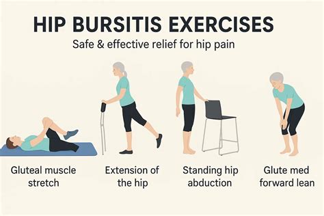 Hip Bursitis Exercises Pdf