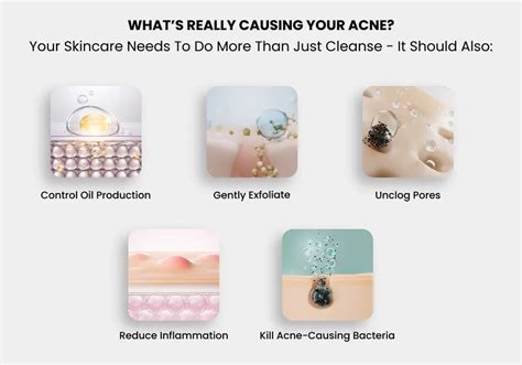 How to Build an Acne-Safe Skincare Routine (Dermatologists-Approved Gu ...