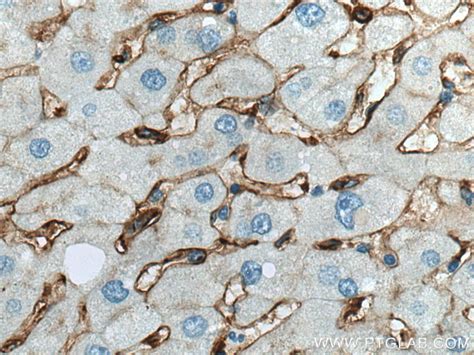 CD14 antibody (17000-1-AP) | Proteintech