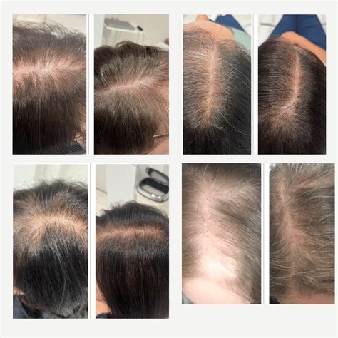 My menopause, my hair! | My Menopause Centre