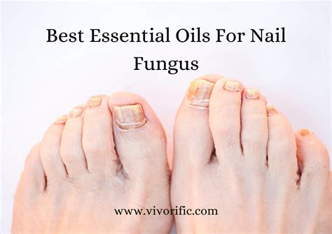 Best Essential Oils For Nail Fungus