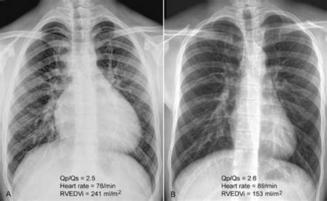 Image result for Lgorithm Visualizations