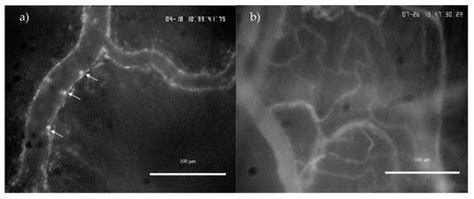 Experimental Cannabinoid 2 Receptor Activation by Phyto-Derived and ...
