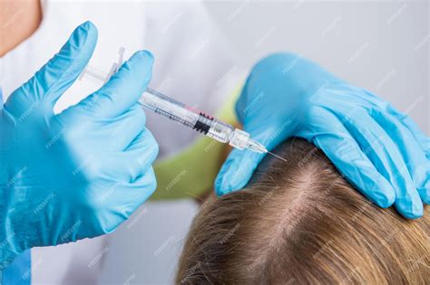 Le médecin fait des injections de mésothérapie dans la tête de la femme ...