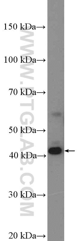 STK17B antibody (26600-1-AP) | Proteintech