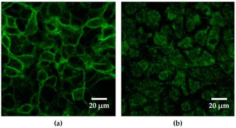 Escherichia coli Alpha-Hemolysin HlyA Induces Host Cell Polarity ...