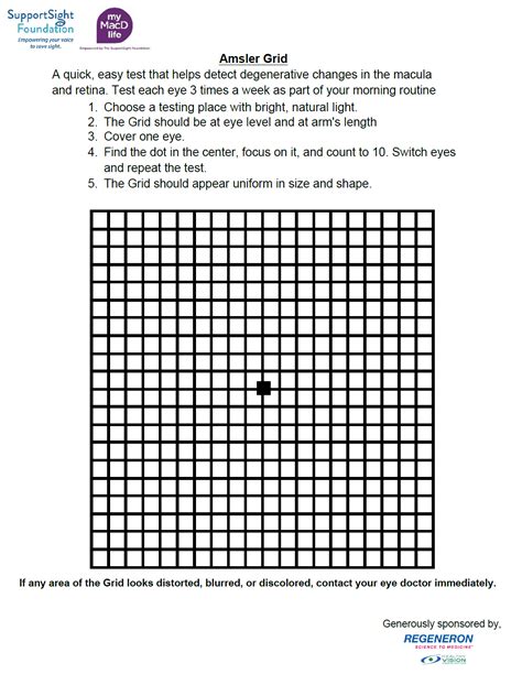 Diagnosis - Support Sight Foundation