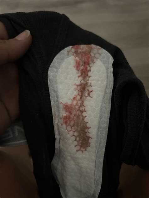 Implantation Bleeding Discharge Pictures Implantation Bleed [Content