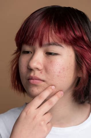 The Ultimate Guide: How to Hide Dark Spots on Face with Makeup – De ...