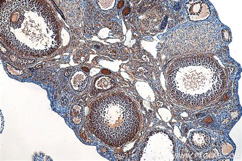 Inhibin alpha antibody (27331-1-AP) | Proteintech