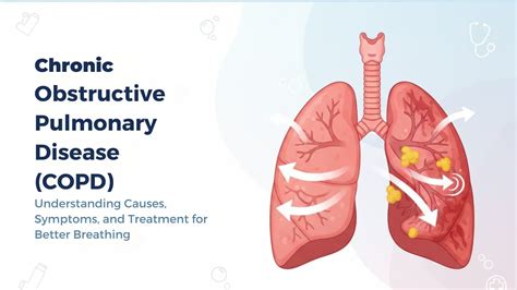 Platelet Distribution Width Explained: A Key Indicator in Blood Tests ...
