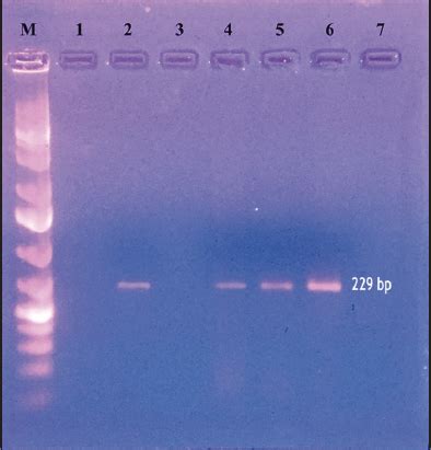 Molecular epidemiology of Mycobacterium avium subspecies ...