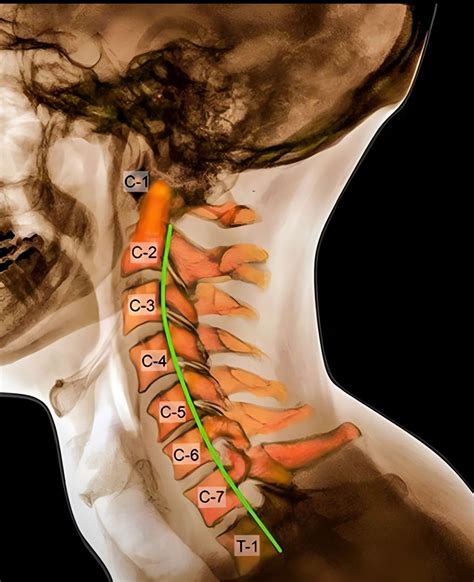 The cervical spine consists of: ⏺️ 7 vertebrae: C1 (Atlas), C2 (Axis), C3, C4, C5, C6, and C7 ⏺️ ...
