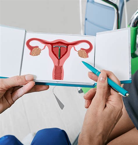 IUD Contraception Info - Gynaecology Centres Australia