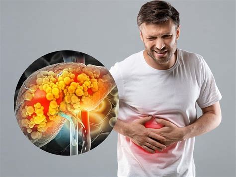 7 Powerful Yoga Asanas That Can Help Cure Fatty Liver Naturally Without ...