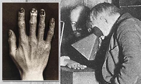 Clarence Dally — The Man Who Gave Thomas Edison X-Ray Vision https ...