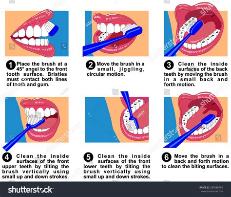 Image result for How to Clean Front Teeth Partials