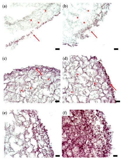 3D Bioprinting of Model Tissues That Mimic the Tumor Microenvironment