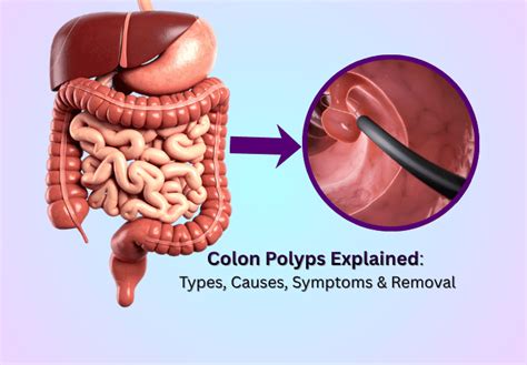 Pap Smear Screening for Cervical Cancer: All You Need to Know