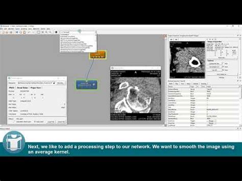 Image result for MeVisLab Features