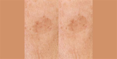 Aging Sign 的图像结果