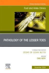Pathology of the Lesser Toes, An issue of Foot a: 1st edition | Edited ...