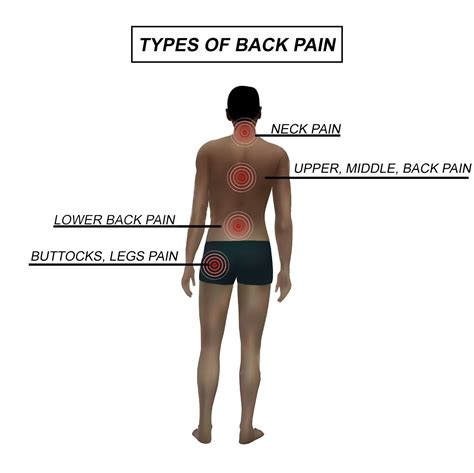 Lower Back Pain Location