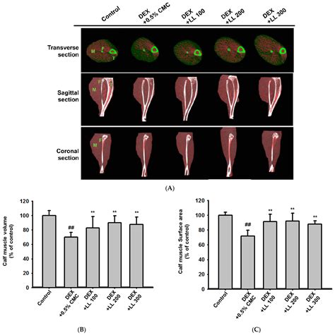 Water Extract of Lotus Leaf Alleviates Dexamethasone-Induced Muscle ...