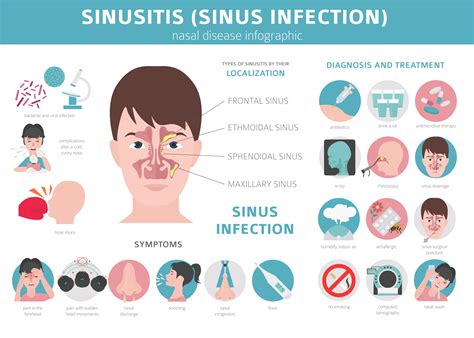 Sinus Infection (Sinusitis): Causes, Symptoms and Treatment