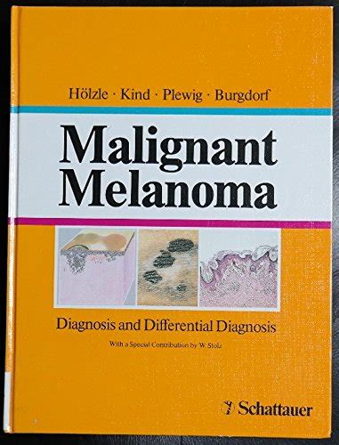 Buy Melanoma: Diagnosis and Differential Diagnosis Book Online at Low ...