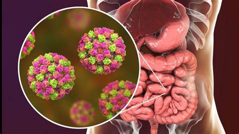 If you have a 'stomach flu,' chances are it's actually norovirus: What you should know | whas11.com
