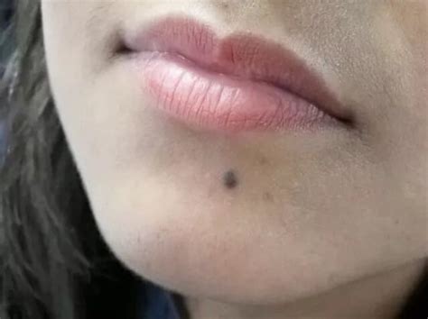 If there is more mole on the face then do not think it is lucky, it may ...