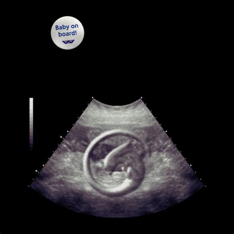 Image result for Alien Ultrasound