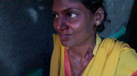 Discrimination, Growing Resistance to Drugs Fuelling India's ...