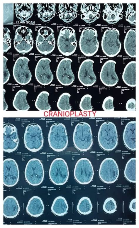 Photo Gallery - Dr Vivek Agrawal