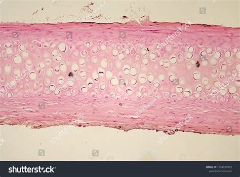Hyaline Cartilage Under Microscope Mammal. Trachea. Transverse