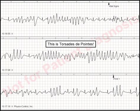 ECG Solution – Get to the point!