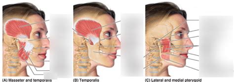 Muscles of Mastication Lecture 的图像结果