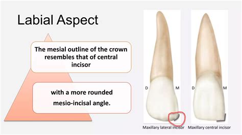 Permanent Maxillary Lateral Incisors-Dr Saba Arshad | PPTX