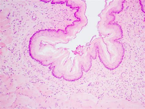 Image result for Radioactivite Corps Humain