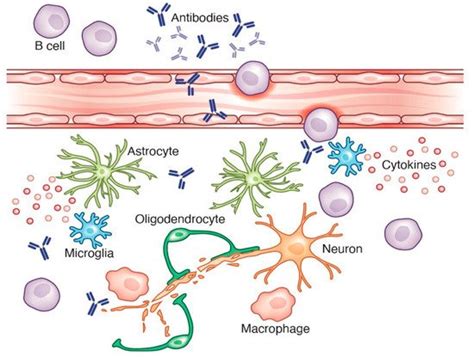 B Cells in Neuroinflammation | Encyclopedia MDPI