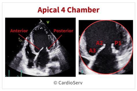 Mitral Valve Orientation in Echo: Anatomy & Scallops Expained!