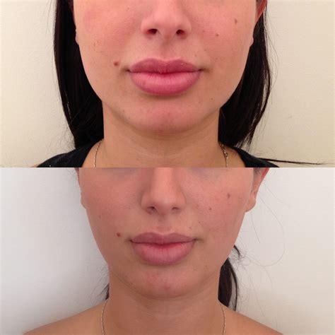 Medical Spa West LA & La Cañada Flintridge | Skin Specifics | facial reshaping 8295