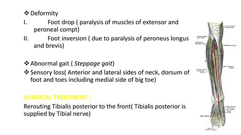 ANATOMY OF SCIATIC NERVE AND FOOT DROP | PPTX